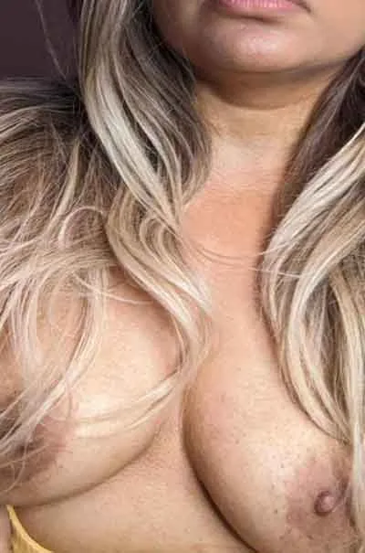 Malin Rakkestad